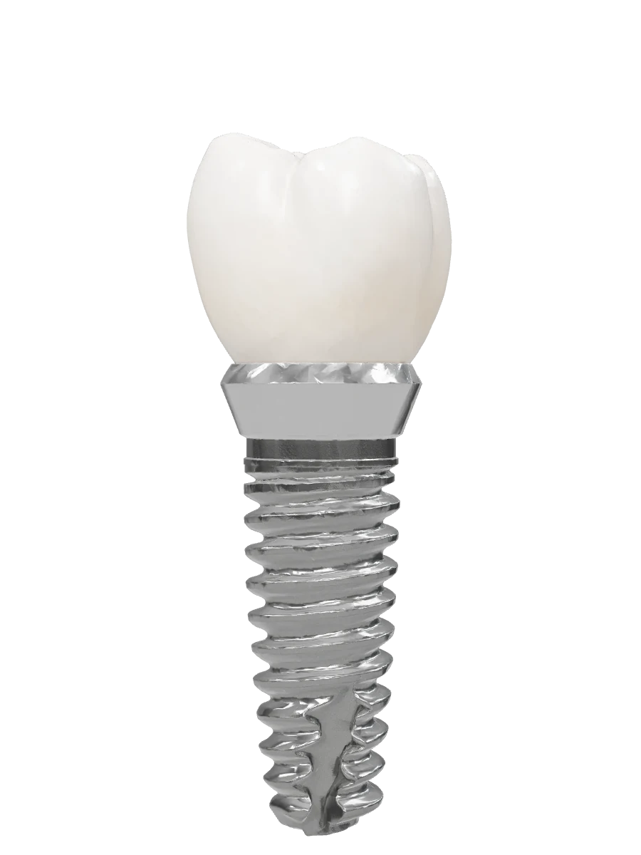Dental implant post, abutment and ceramic crown